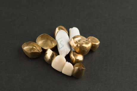 Who Buys Scrap Dental Gold in Idaho? - Idaho Pawn & Gold